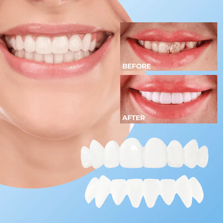 SNAP-ON SMILE Carillas dentales con clip